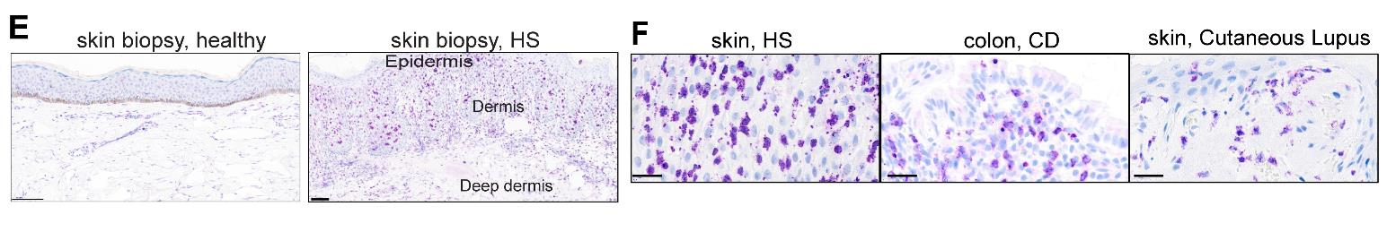 Agonistic anti-DCIR antibody inhibits ITAM-mediated inflammatory signaling and promotes immune resolution